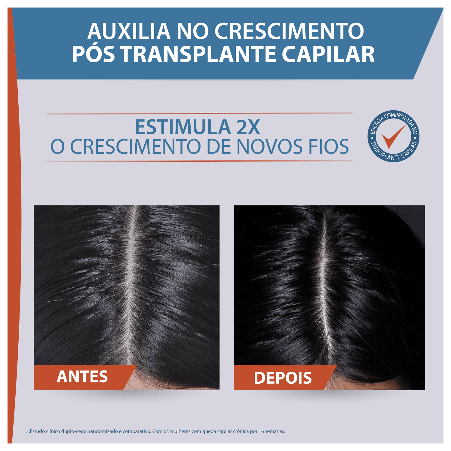 Kit Ducray Neoptide Expert Sérum Capilar Antiqueda (2 Unidades)