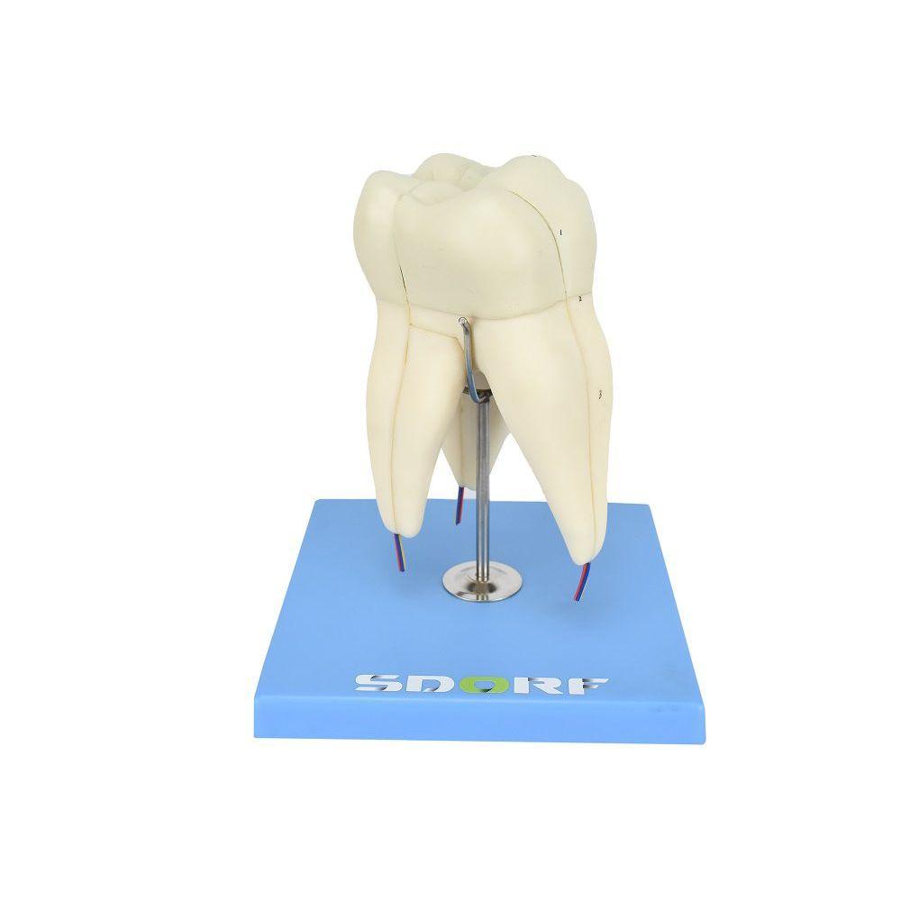 Miniatura Dente Molar Superior C/ Raiz Tripla Em 3 Partes, 8x