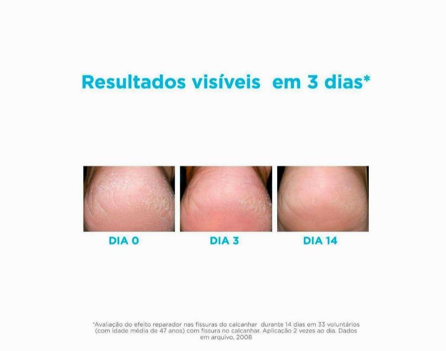 Miniatura Hidratante Para Os Pés Isdin Foot Care Ureadin Podos Gel 80,