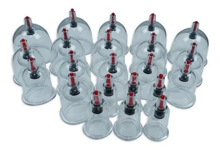 Kit Ventosas Vácuo Terapia Sucção Ventosa Cupping Acupuntura