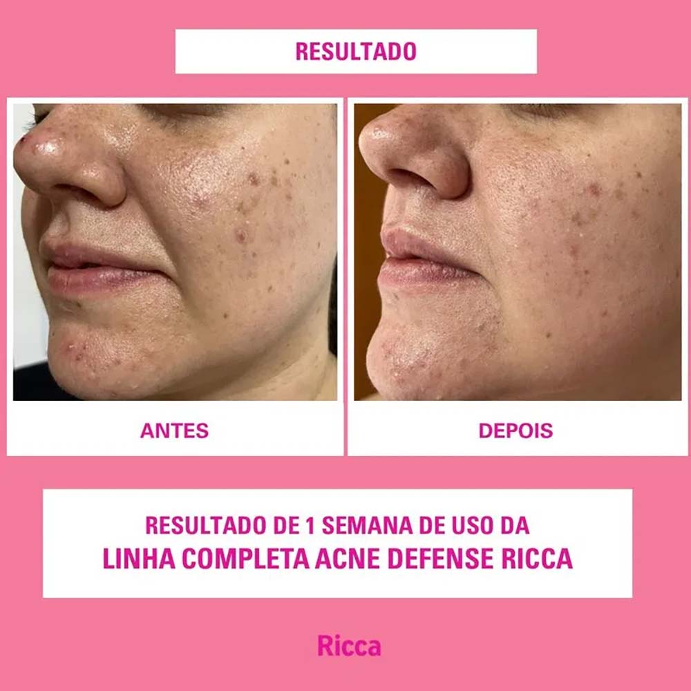 Miniatura Sabonete Líquido Facial Acne Defense Ricca 150g