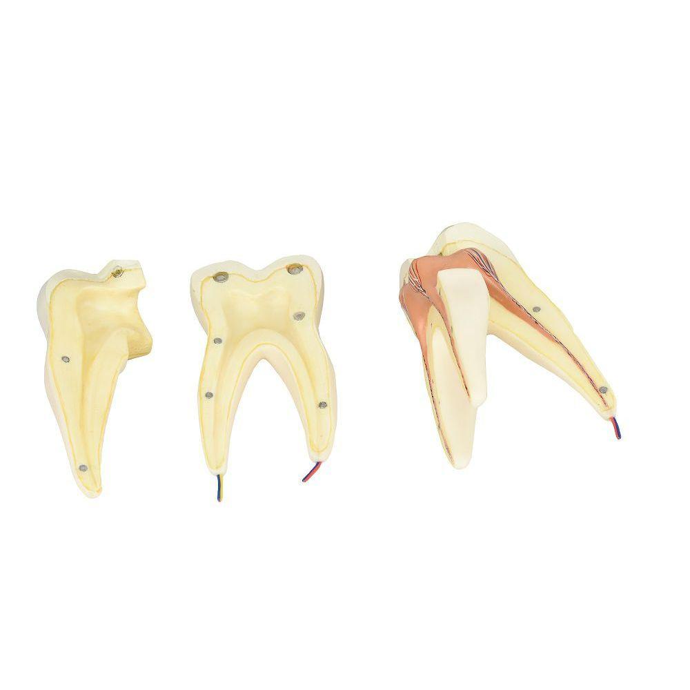 Miniatura Dente Molar Superior C/ Raiz Tripla Em 3 Partes, 8x
