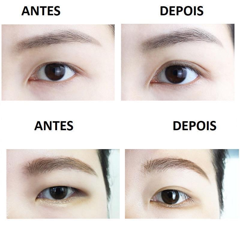 Fita Adesiva para Levantar Pálpebras - 600 Unidades