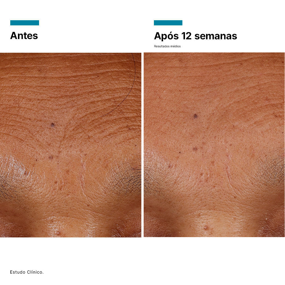 Miniatura Sérum Volumizador SkinCeuticals HA Intensifier Multi Glycan Correção 30ml