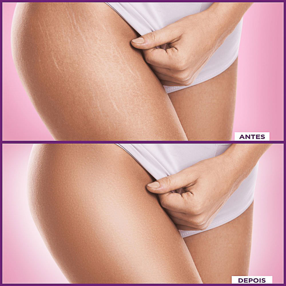 Miniatura Cicatricure Gel para Cicatrizes e Estrias 30g