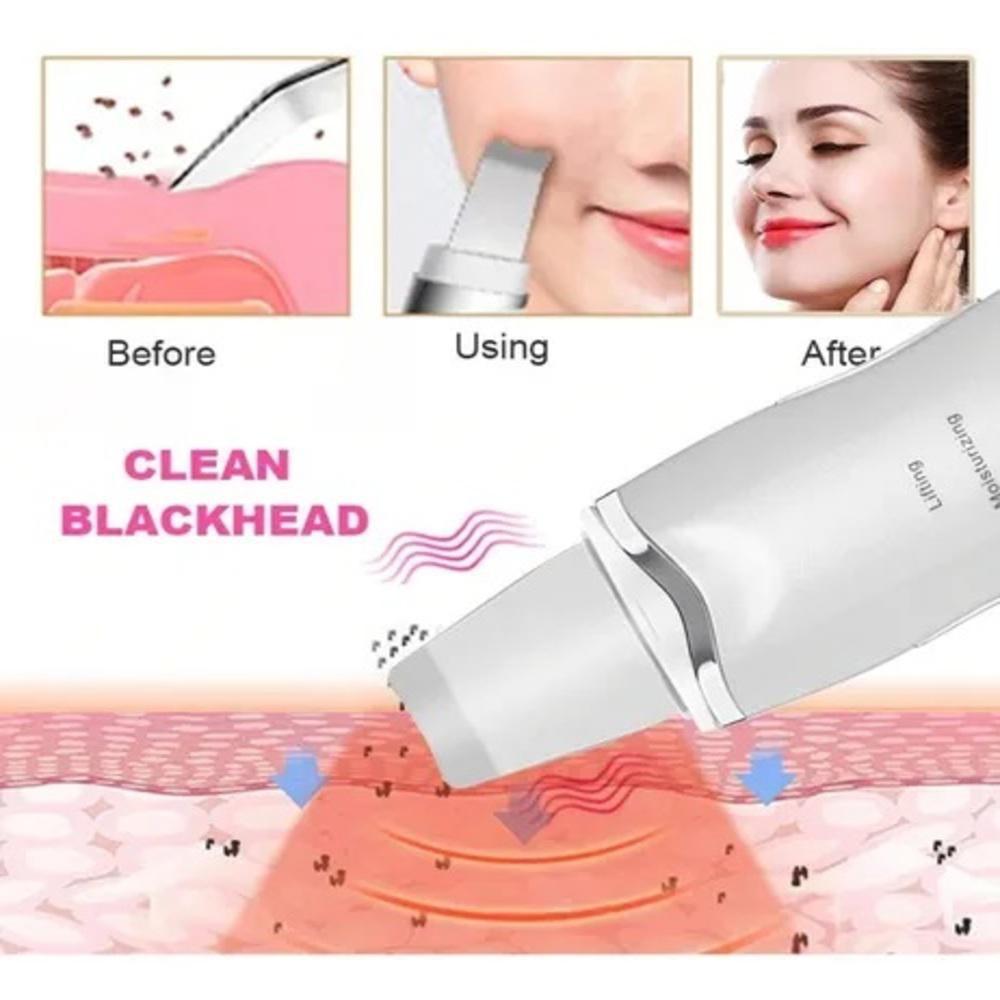 Miniatura Aparelho Peeling Ultrassónico Portátil Lifting Limpeza Pele