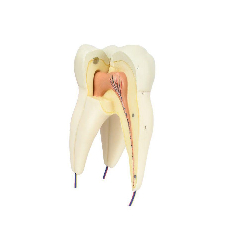 Miniatura Dente Molar Superior C/ Raiz Tripla Em 3 Partes, 8x