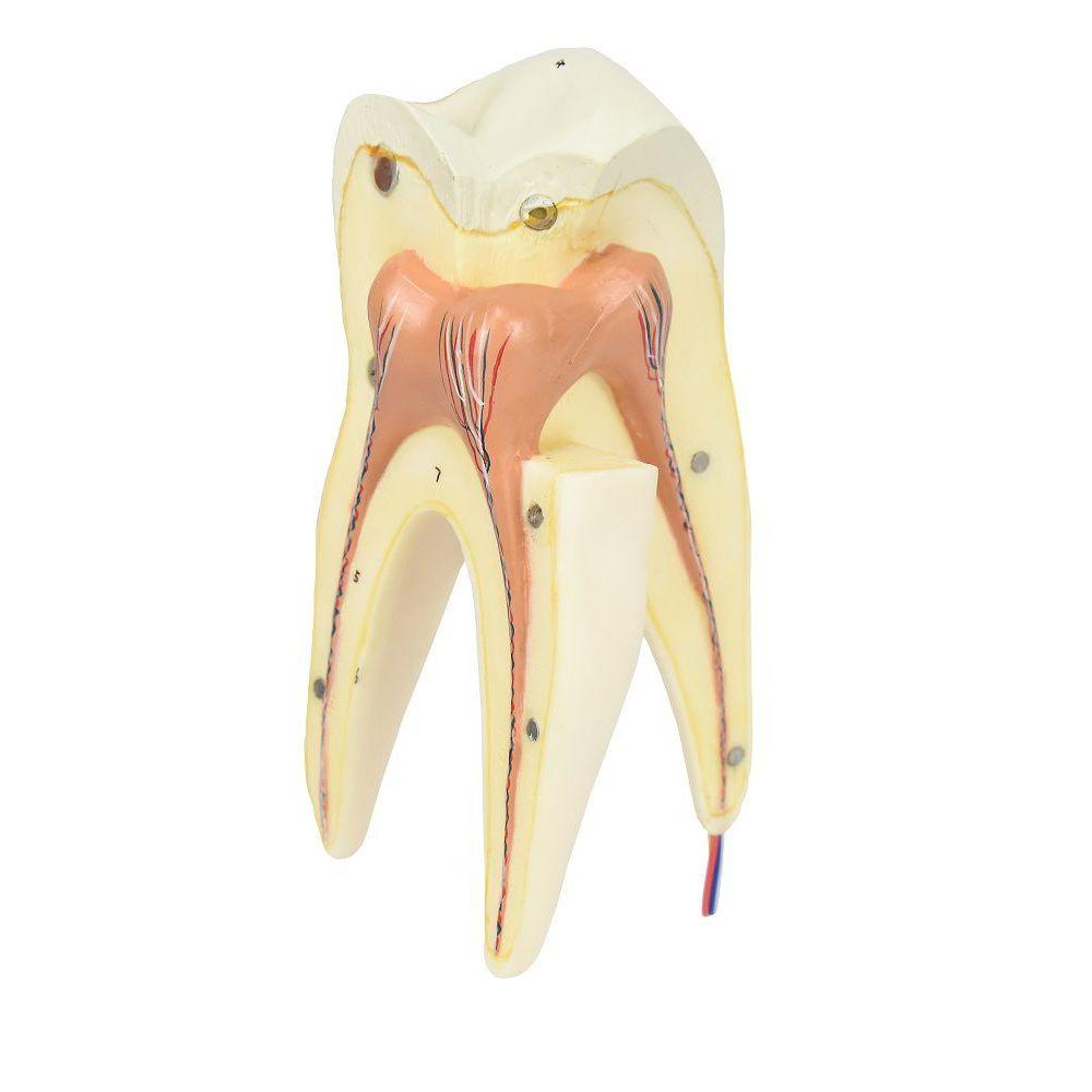 Miniatura Dente Molar Superior C/ Raiz Tripla Em 3 Partes, 8x