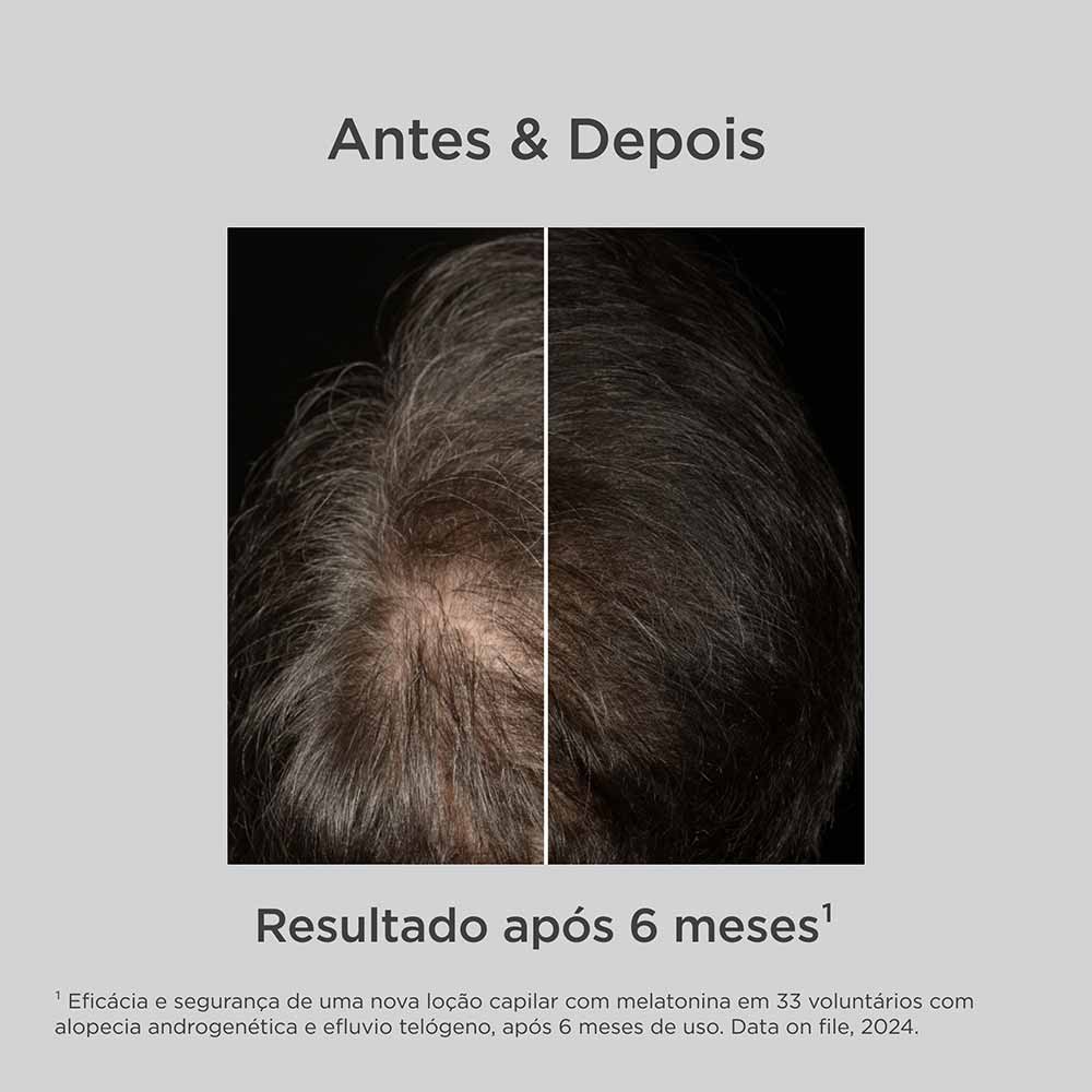 Miniatura Isdin Hair Care Loção Antiqueda Melatonin Concentrate 100ml