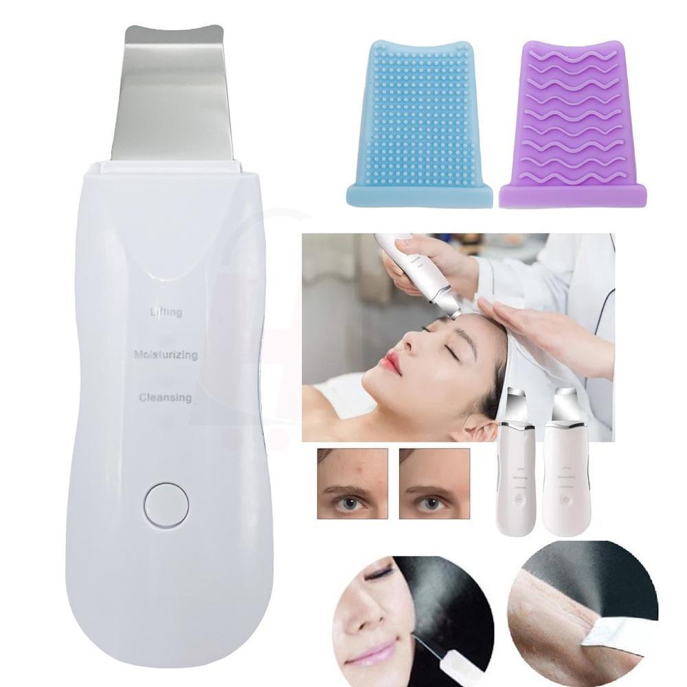 Aparelho Peeling Ultrassónico Portátil Lifting Limpeza Pele