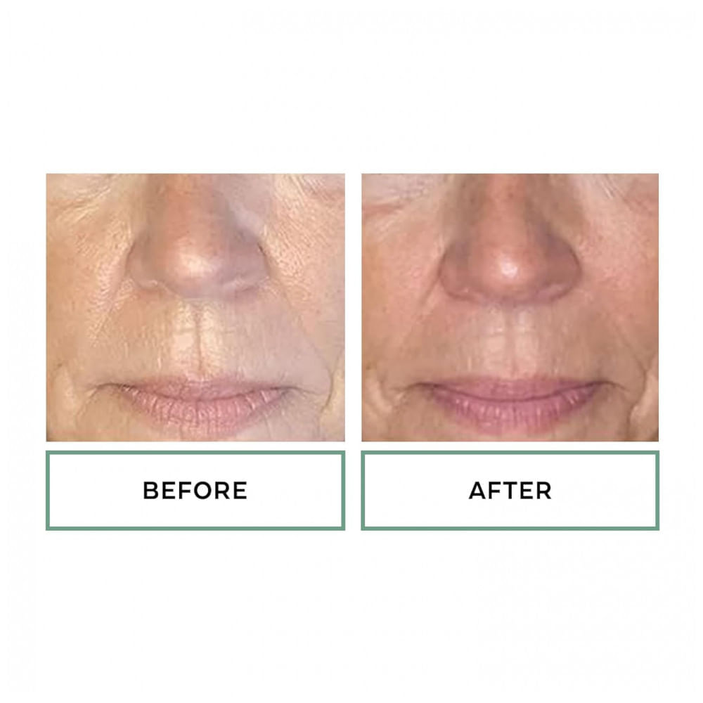 Miniatura Noturno Anti Idade para Rosto e Pescoço com Ceramidas e Chá, REPLENIX 895, Branco