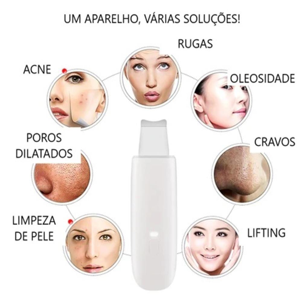 Miniatura Aparelho Peeling Ultrassónico Portátil Lifting Limpeza Pele