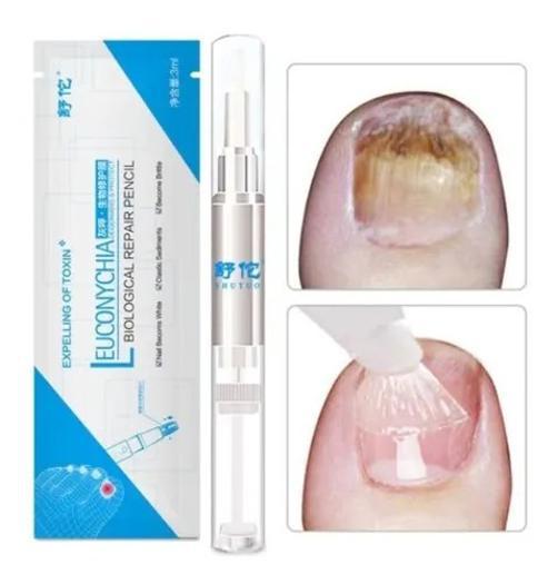 Caneta Esmalte Anti Fungo Micose Fortalece Unhas 3 Peças