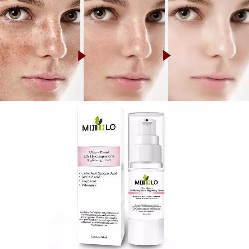 Miniatura Creme Manchas Melasma Ultra Potente Ácidos 2% Hidroquinona Produto Importado Nacional - Emulsão - Anti-manchas - Ultra-potente 2% hidroquinona - 30 - Mista - 1