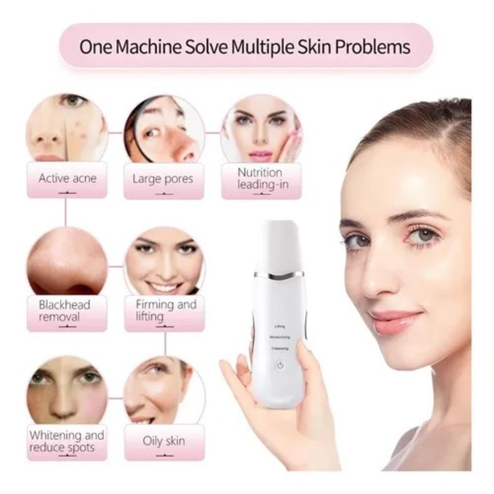 Miniatura Aparelho Peeling Ultrassónico Portátil Lifting Limpeza Pele