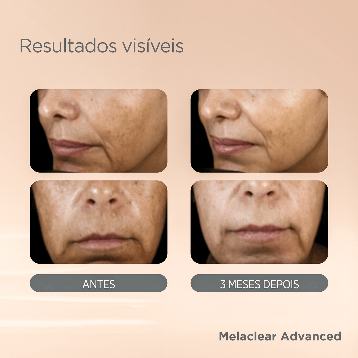 Miniatura ISDIN ISDINCEUTICS Melaclear Advanced Refil - Sérum Facial Uniformizador 30ml