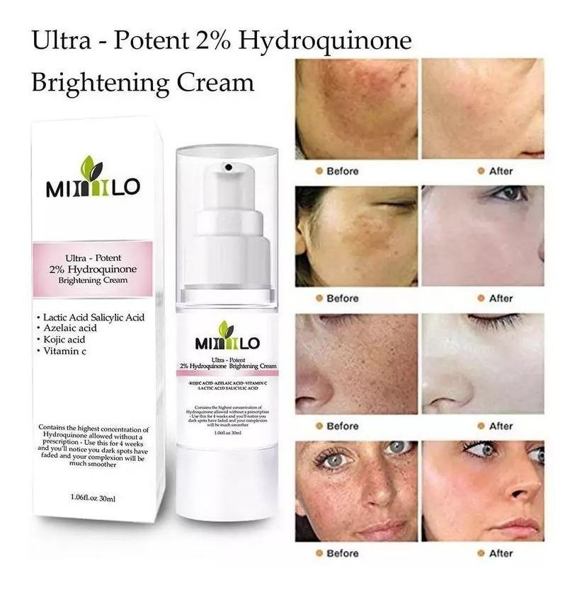 Miniatura Creme Manchas Melasma Ultra Potente Ácidos 2% Hidroquinona Produto Importado Nacional - Emulsão - Anti-manchas - Ultra-potente 2% hidroquinona - 30 - Mista - 1