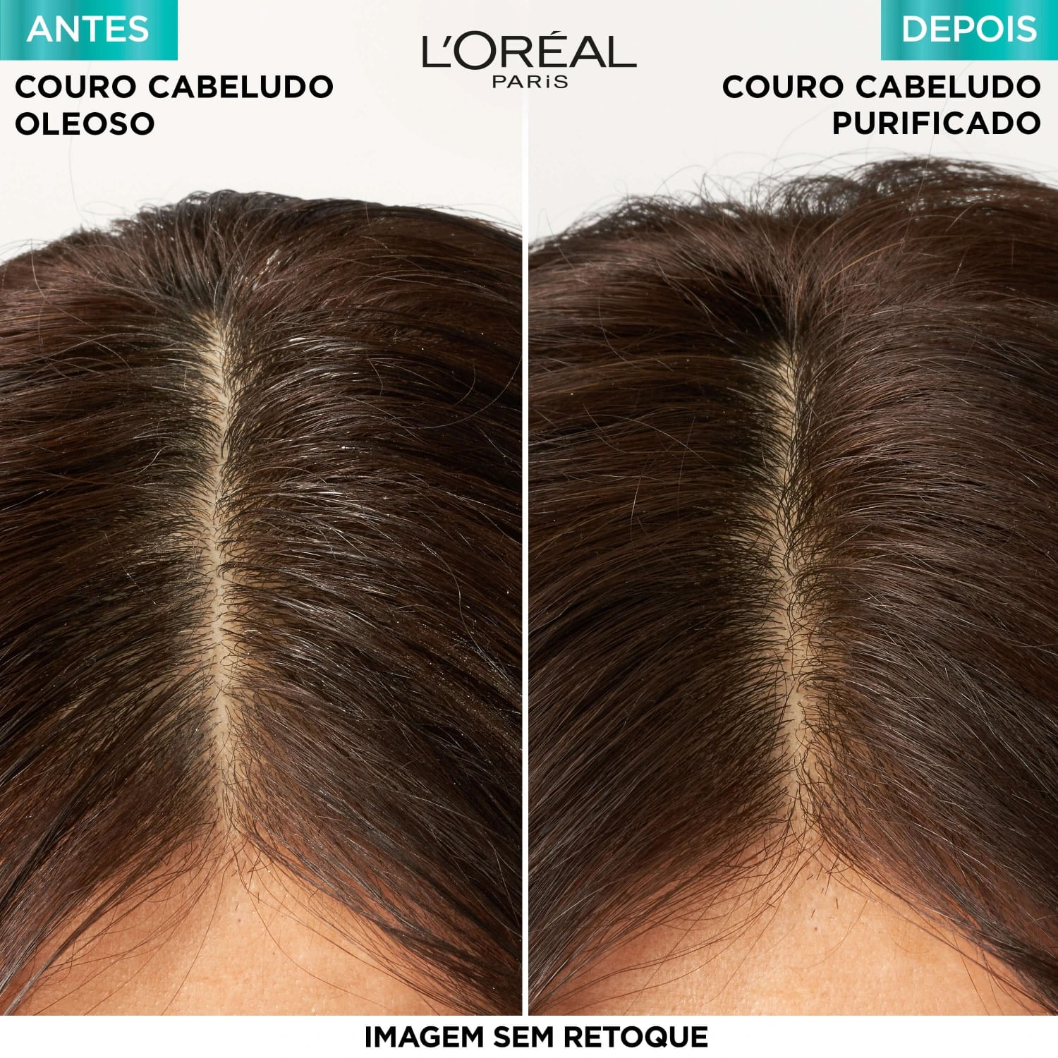 Miniatura Kit Elseve L'Oréal Paris Pure Hialurônico (2 Produtos)