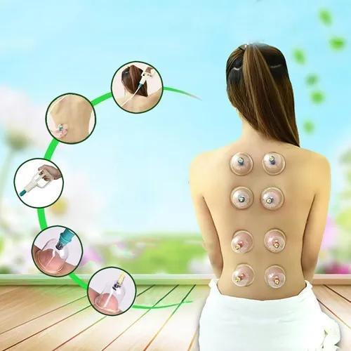 Kit Ventosas Vácuo Terapia Sucção Ventosa Cupping Acupuntura