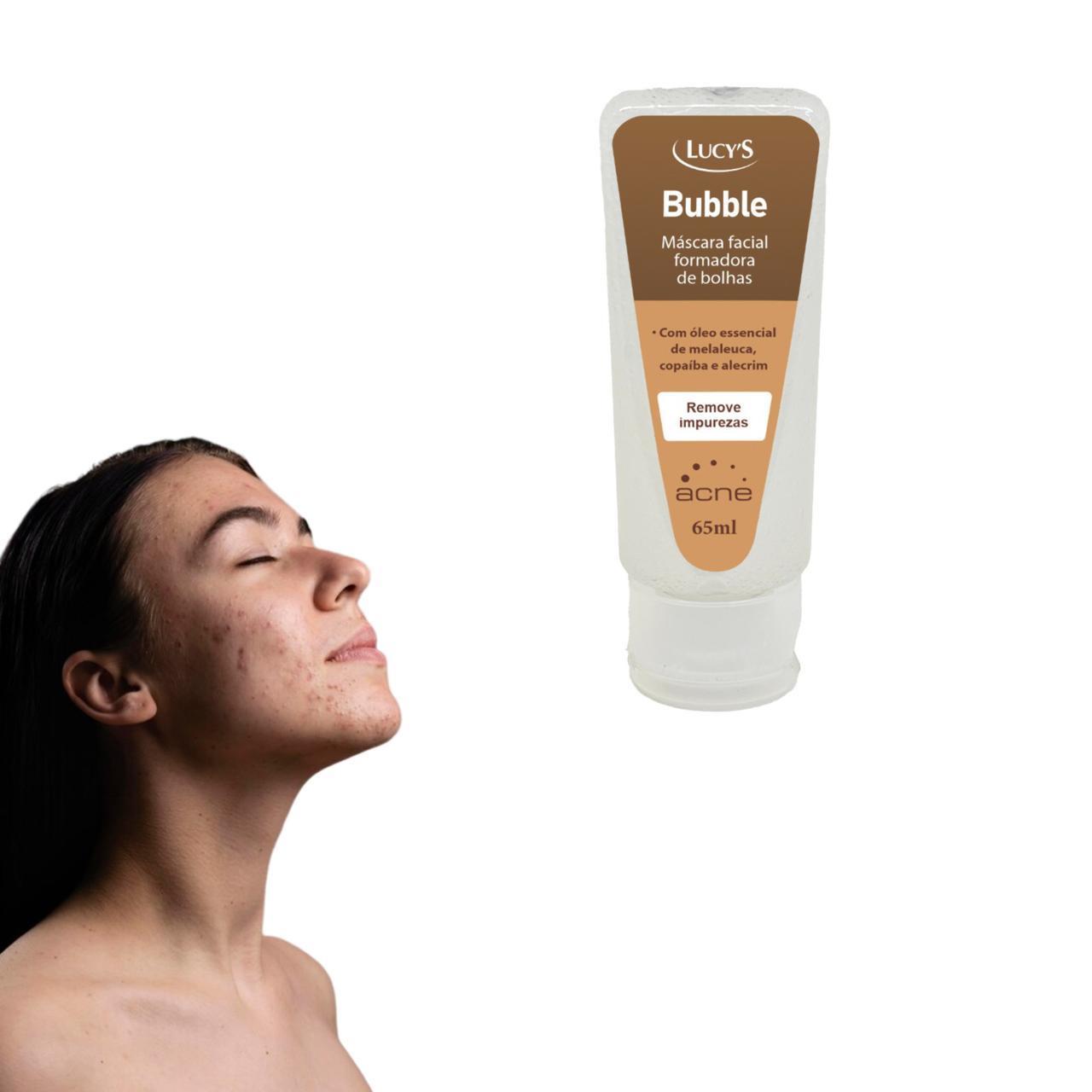 Miniatura Acne Máscara Bubble Facial Formadora De Bolhas