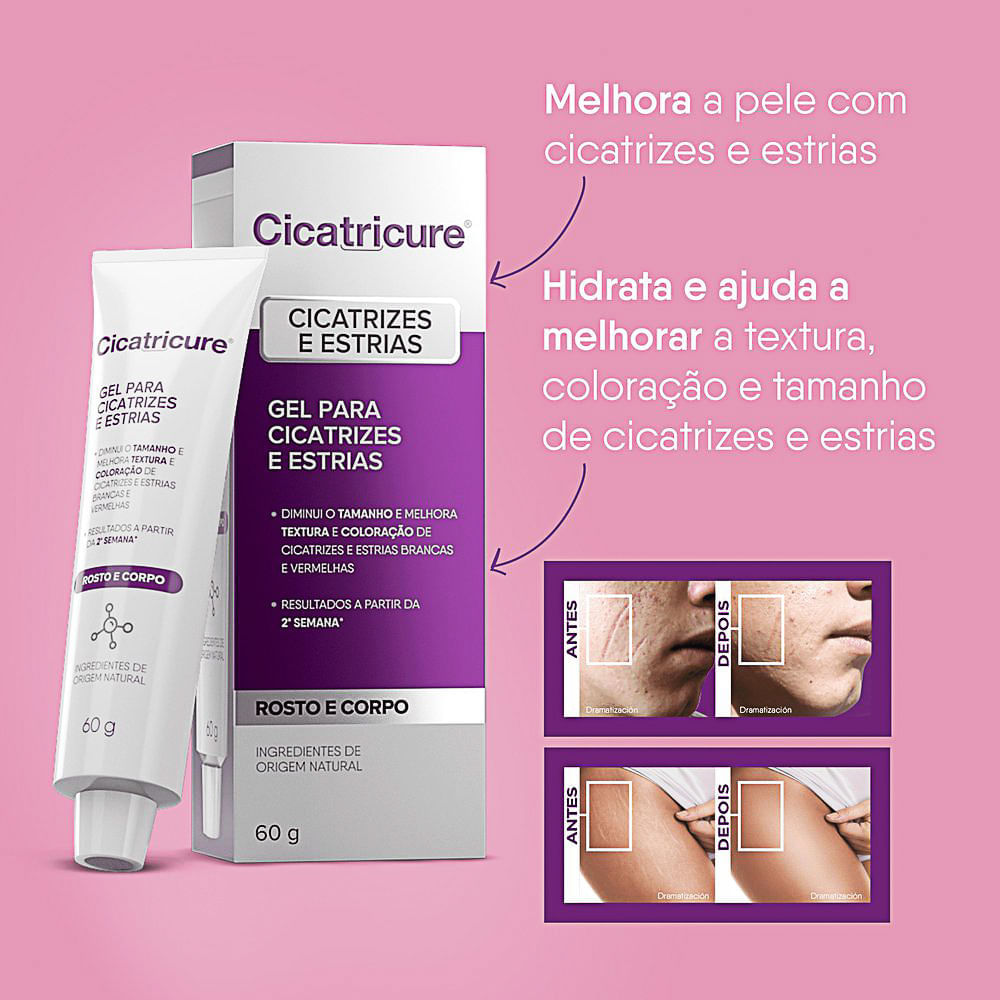 Miniatura Cicatricure Gel para Cicatrizes e Estrias 30g
