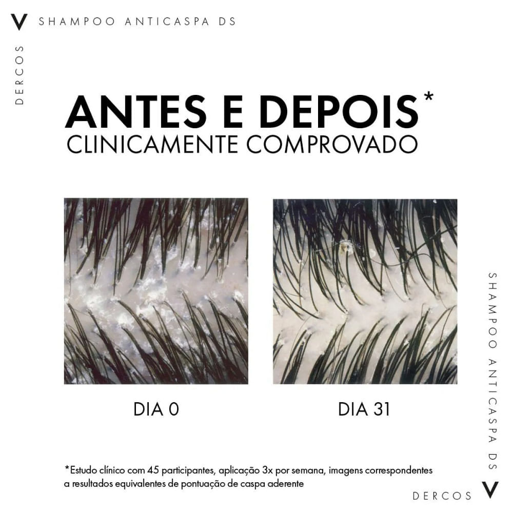 Refil Shampoo Anticaspa Ds Vichy Dercos Oily Cabelos Normais a Oleosos 200g