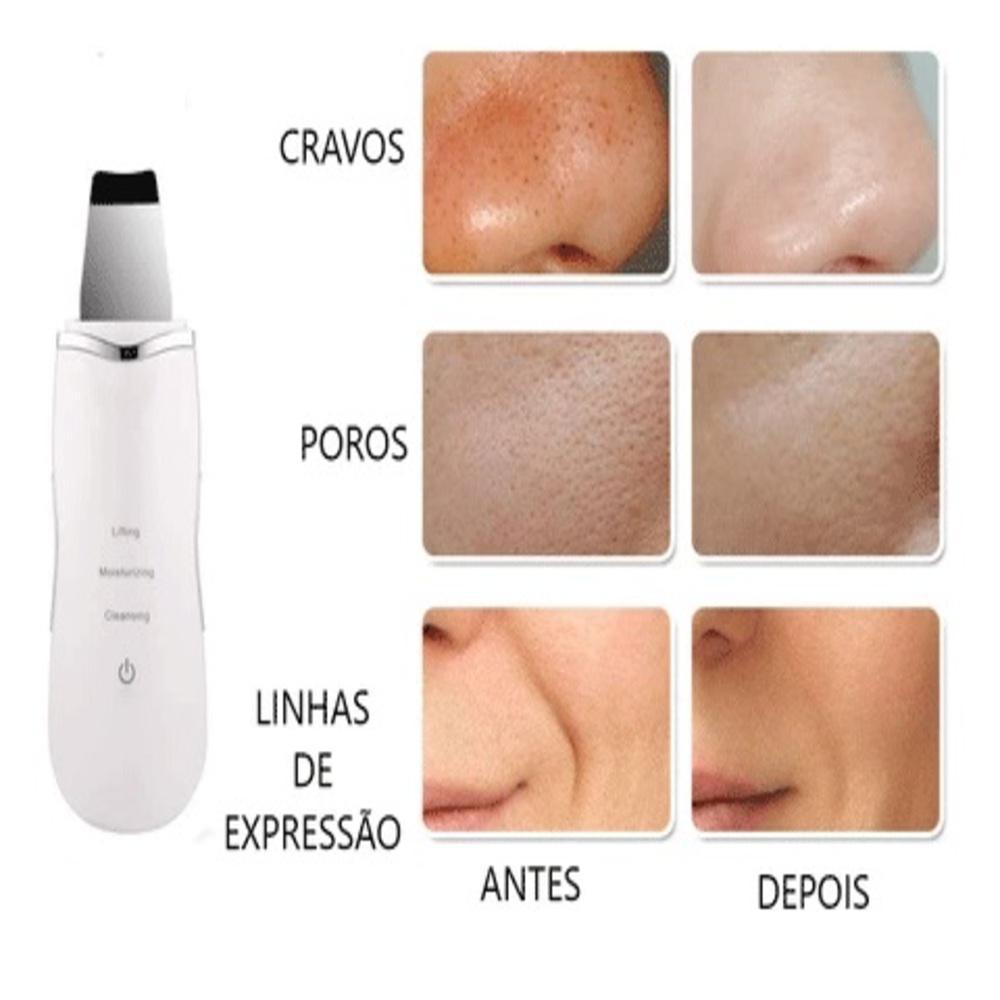 Miniatura Aparelho Peeling Ultrassónico Portátil Lifting Limpeza Pele